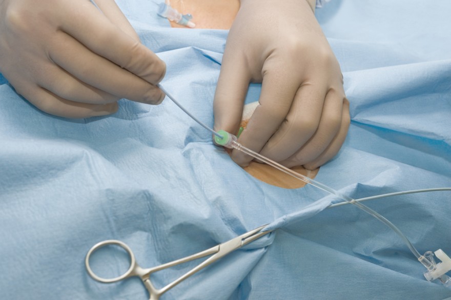 Catheterization at Home in Gurgaon